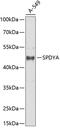 Speedy protein A antibody, 15-101, ProSci, Western Blot image 