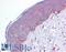 TSC Complex Subunit 2 antibody, LS-B1654, Lifespan Biosciences, Immunohistochemistry paraffin image 