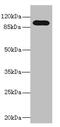 Toll Like Receptor 6 antibody, CSB-PA023605LA01HU, Cusabio, Western Blot image 