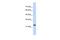 TATA-Box Binding Protein Associated Factor 12 antibody, PA5-46867, Invitrogen Antibodies, Western Blot image 