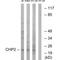 Calcineurin Like EF-Hand Protein 2 antibody, A08478, Boster Biological Technology, Western Blot image 