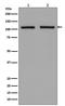 Hexokinase 1 antibody, M01504, Boster Biological Technology, Western Blot image 