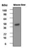 Betaine--Homocysteine S-Methyltransferase antibody, GTX50061, GeneTex, Western Blot image 