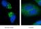 Sequestosome 1 antibody, 66184-1-Ig, Proteintech Group, Immunofluorescence image 
