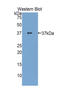 Zeta Chain Of T Cell Receptor Associated Protein Kinase 70 antibody, LS-C297034, Lifespan Biosciences, Western Blot image 