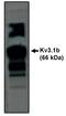Potassium Voltage-Gated Channel Subfamily C Member 1 antibody, MBS395410, MyBioSource, Western Blot image 