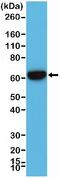 Keratin 5 antibody, NBP2-77439, Novus Biologicals, Western Blot image 
