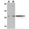 NSE2 (MMS21) Homolog, SMC5-SMC6 Complex SUMO Ligase antibody, MBS150826, MyBioSource, Western Blot image 