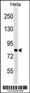 Zinc Finger Protein 131 antibody, 59-135, ProSci, Western Blot image 