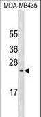 Mucin 1, Cell Surface Associated antibody, LS-C164674, Lifespan Biosciences, Western Blot image 