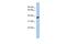 Cytochrome B5 Reductase Like antibody, PA5-70199, Invitrogen Antibodies, Western Blot image 