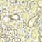 Mitogen-Activated Protein Kinase Kinase 2 antibody, LS-C330876, Lifespan Biosciences, Immunohistochemistry frozen image 