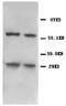 BCL2 Interacting Protein 3 antibody, PA5-78882, Invitrogen Antibodies, Western Blot image 