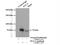 Propionyl-CoA Carboxylase Subunit Alpha antibody, 21988-1-AP, Proteintech Group, Immunoprecipitation image 