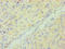 CD33 Molecule antibody, LS-C375424, Lifespan Biosciences, Immunohistochemistry paraffin image 