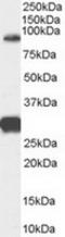 Forkhead Box P2 antibody, TA303169, Origene, Western Blot image 