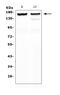 Myosin Binding Protein C, Cardiac antibody, A01078-1, Boster Biological Technology, Western Blot image 