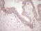 RB Transcriptional Corepressor 1 antibody, LS-C790679, Lifespan Biosciences, Immunohistochemistry paraffin image 