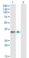 Ring Finger Protein 212 antibody, MA5-23246, Invitrogen Antibodies, Western Blot image 