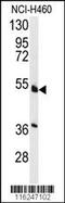 HNF-4-alpha antibody, 61-499, ProSci, Western Blot image 