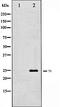 Transketolase antibody, orb99408, Biorbyt, Western Blot image 