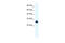 General Transcription Factor IIF Subunit 2 antibody, 27-345, ProSci, Western Blot image 