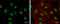 High Mobility Group AT-Hook 2 antibody, GTX100519, GeneTex, Immunocytochemistry image 