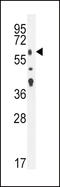 Transforming Growth Factor Beta Receptor 2 antibody, LS-B12077, Lifespan Biosciences, Western Blot image 