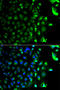 RAB5A, Member RAS Oncogene Family antibody, STJ25263, St John