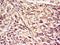 Spleen Associated Tyrosine Kinase antibody, orb11439, Biorbyt, Immunohistochemistry paraffin image 