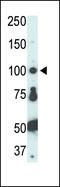 FER Tyrosine Kinase antibody, 63-159, ProSci, Western Blot image 