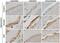 F11 Receptor antibody, H00050848-M01, Novus Biologicals, Immunohistochemistry paraffin image 