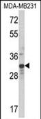 MAX Dimerization Protein MLX antibody, PA5-72546, Invitrogen Antibodies, Western Blot image 