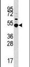 MAPK Activated Protein Kinase 5 antibody, PA5-14043, Invitrogen Antibodies, Western Blot image 