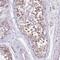 Cytochrome C Oxidase Copper Chaperone COX17 antibody, PA5-61671, Invitrogen Antibodies, Immunohistochemistry frozen image 