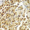 Staphylococcal Nuclease And Tudor Domain Containing 1 antibody, LS-C334352, Lifespan Biosciences, Immunohistochemistry frozen image 