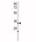 Insulin Like Growth Factor Binding Protein 2 antibody, F51220-0.4ML, NSJ Bioreagents, Western Blot image 