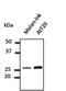 RAB27A, Member RAS Oncogene Family antibody, orb11623, Biorbyt, Western Blot image 