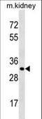 Cathepsin L antibody, LS-C158191, Lifespan Biosciences, Western Blot image 