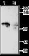 Potassium Voltage-Gated Channel Subfamily A Member 5 antibody, GTX54837, GeneTex, Western Blot image 