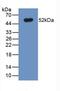 Solute Carrier Family 40 Member 1 antibody, LS-C711557, Lifespan Biosciences, Western Blot image 