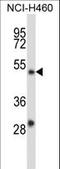 YY2 Transcription Factor antibody, LS-C160706, Lifespan Biosciences, Western Blot image 