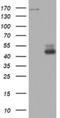 DNA Topoisomerase II Alpha antibody, NBP2-46184, Novus Biologicals, Western Blot image 