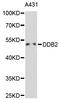 Damage Specific DNA Binding Protein 2 antibody, STJ23354, St John