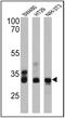 Caudal Type Homeobox 2 antibody, MA5-14494, Invitrogen Antibodies, Western Blot image 