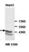 Alpha-Methylacyl-CoA Racemase antibody, orb77057, Biorbyt, Western Blot image 