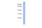 GS Homeobox 1 antibody, A13105, Boster Biological Technology, Western Blot image 