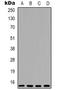 Eukaryotic Translation Initiation Factor 4E Binding Protein 1 antibody, orb338923, Biorbyt, Western Blot image 