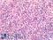 CD11b antibody, LS-A12408, Lifespan Biosciences, Immunohistochemistry paraffin image 