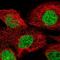 Tankyrase 2 antibody, NBP1-80947, Novus Biologicals, Immunofluorescence image 
